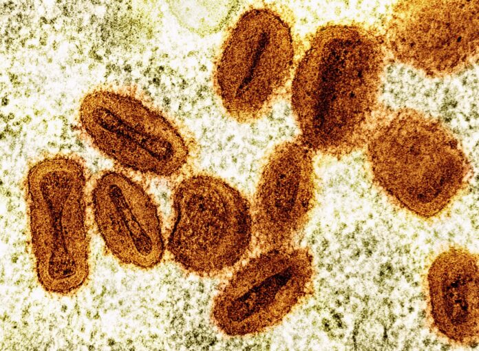 Colorized transmission electron micrograph of mpox virus particles (orange) found within an infected cell (green), cultu