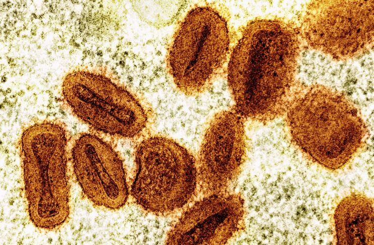 Colorized transmission electron micrograph of mpox virus particles (orange) found within an infected cell (green), cultu